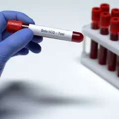 Ręka w niebieskiej rękawiczce trzyma probówkę z napisem "Beta hCG - Test". W tle stojak z innymi próbkami krwi. Czy beta hcg z krwi może się mylić?