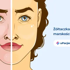 Twarz podzielona na dwie części: zdrową i zażółconą, ilustrująca żółtaczkę przy marskości wątroby.