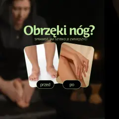 Obrzęki nóg? Zobacz, jak szybko je zmniejszyć dzięki masażowi limfatycznemu. Porównanie "przed" i "po" pokazuje efekty.