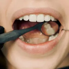 Badanie jamy ustnej, lustro dentystyczne odbija zęby, a narzędzie bada przyzębie.