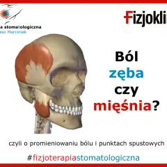 Model czaszki z zaznaczonym mięśniem żwaczem. Pytanie: Ból zęba czy mięśnia? Może to być ból dziąsła na końcu szczęki. #fizjoterapiastomatologiczna