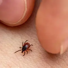 Garrapata marrón sobre piel humana, cerca de los dedos.