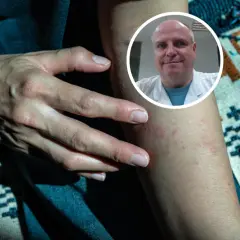 Dermatolog czy onkolog? Gdzie iść z niepokojącym znamieniem?
