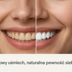 Przed i po: jak wybielić zęby, by uzyskać olśniewający uśmiech i naturalną pewność siebie.