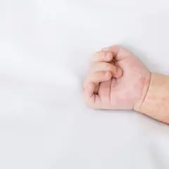Różowa, nieswędząca wysypka u dziecka na białym tle.