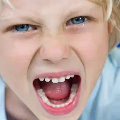 Niño con ojos azules muy abiertos y boca gritando, mostrando una expresión de enojo que podría indicar un trastorno negativista desafiante.