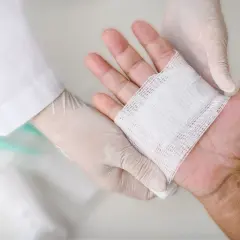 Opatrunki na oparzenia dłoni zakładane przez osobę w białej rękawiczce.