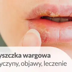 Opryszczka wargowa, jedna z chorób na ustach, objawia się pęcherzykami i strupkami. Palec zbliża się do ust.