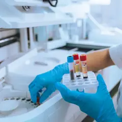 Ręce w niebieskich rękawiczkach trzymają probówki z krwią przy aparaturze laboratoryjnej.