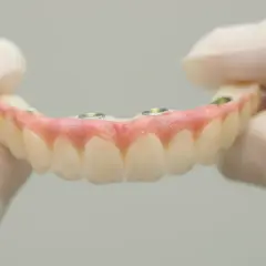 Górna proteza bez podniebienia, mocowana na implantach, prezentowana przez dłonie w rękawiczkach.