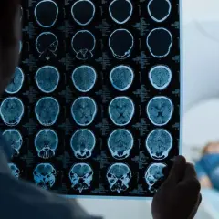 Lekarz analizuje wyniki rezonansu magnetycznego głowy, wykonanego w ramach testu na wstrząs mózgu. W tle pacjent leży w aparacie MRI.