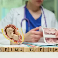 Model płodu i klocki z napisem "SPINA BIFIDA" symbolizują diagnozę wady rozwojowej. Lekarz analizuje wyniki badań.