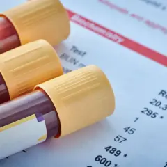 Próbki krwi w probówkach z żółtymi nakrętkami leżą na papierze z wynikami badań. Może to być badanie dla ukochanego psa.