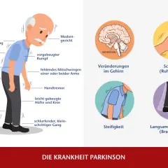 Die entscheidenden Schritte zur Parkinson Diagnostik verstehen