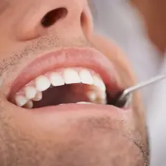 Ból zęba przed dentystą? Jakie leki są bezpieczne, a czego unikać?