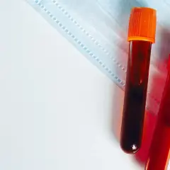 Dwie probówki z krwią, jedna z pomarańczową, druga z czerwoną zakrętką, leżą na niebieskiej masce ochronnej.