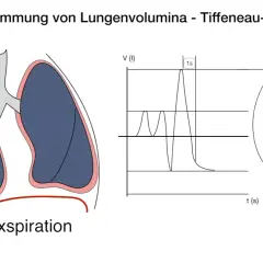 Lungenvolumenbestimmung mittels Tiffeneau-Index: Lunge, Fluss-Volumen-Kurve und Zeit-Volumen-Diagramm.