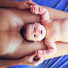 Neugeborenes Baby auf dem Bauch der Mutter, die eine Kaiserschnittnarbe hat. Sanfte Berührung und Heilung durch Osteopathie nach Kaiserschnitt.