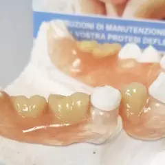 Protesi Deflex su modello dentale. Scopri il protesi deflex prezzo per un sorriso perfetto.