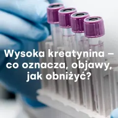 Rękawiczka laboratoryjna trzyma probówki. Tekst: Wysoka kreatynina – co oznacza, objawy, jak obniżyć?