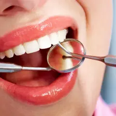 Uśmiech z błyszczącymi zębami, badany lusterkiem dentystycznym. Czy bonding jest odwracalny? To pytanie nurtuje wielu pacjentów.