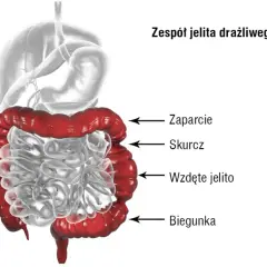 Zaburzenia motoryki jelit: objawy, przyczyny i kiedy szukać pomocy