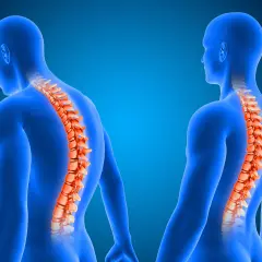 Due figure umane blu mostrano la colonna vertebrale in evidenza arancione. Una ha la schiena insaccata, l'altra una postura eretta.