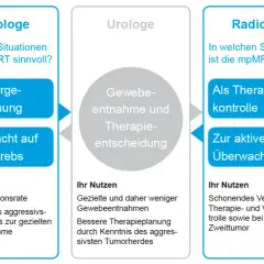 Prostata Vorsorge: So vermeiden Sie teure Behandlungen und Risiken