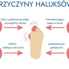Czy haluksy są dziedziczne? Geny, buty i profilaktyka