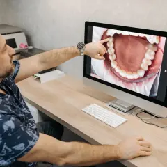 Dentysta pokazuje pacjentowi na monitorze zdjęcie jamy ustnej, wskazując na problem, jak boli kieszonka dziąsłowa.