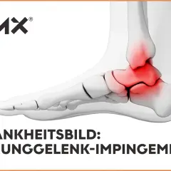 3D-Darstellung eines Fußes mit rot markiertem Sprunggelenk.
