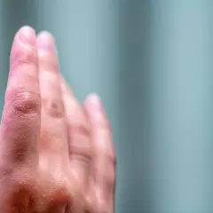 Skóra na opuszkach palców rąk jest zaczerwieniona i lekko łuszcząca się, co może wskazywać na swędzenie opuszków palców u rąk.