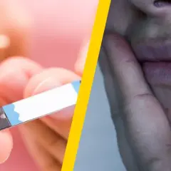 Wysoki cukier niszczy skórę, powodując wypryski. Pomiar glukozy na palcu.