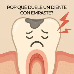 Diente con empaste y caries, con expresión triste y rayos de dolor. ¿Por qué duele una muela empastada al morder?
