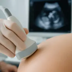 Lekarz wykonuje badania połówkowe, przykładając sondę USG do brzucha ciężarnej. Na ekranie widoczny obraz płodu.