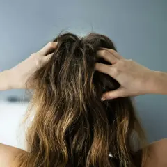 Person kliar sig i håret, upplever problem med fett hår och torr hårbotten.