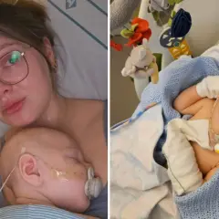 En mamma håller sitt sovande barn. Barnet har en sond och en napp. Det är en tuff tid, men bebis spyr mycket och behöver extra omvårdnad.