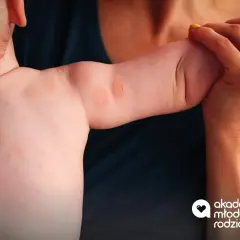 Ręka dziecka z zaczerwienionymi plamkami, które mogą być początki atopowego zapalenia skóry.