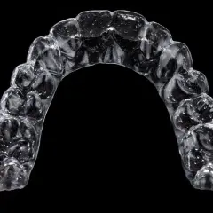 Dita tengono un apparecchio trasparente, un esempio di ultima generazione protesi dentarie mobili invisibili, per un sorriso perfetto.