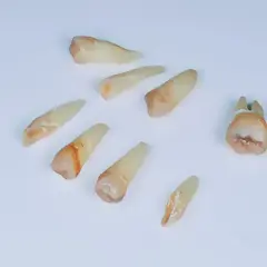 Ból po wyrwaniu ósemki: Jak długo? Kiedy do dentysty?