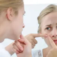 Dziewczyna z pryszczem na twarzy ogląda się w lustrze i dotyka go palcem.