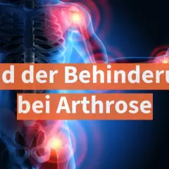 Grafik zeigt menschlichen Körper mit schmerzenden Gelenken. Text: "Grad der Behinderung bei Arthrose".