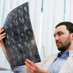 Lekarz analizuje zdjęcie rezonansu magnetycznego, szukając oznak krwiaka w głowie.