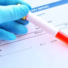 Ręka w niebieskiej rękawiczce trzyma probówkę z krwią nad raportem laboratoryjnym. Wynik ferrytyny to 62.3 ng/ml, co mieści się w normie.