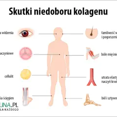 Objawy niedoboru kolagenu: Rozpoznaj i skutecznie uzupełnij!