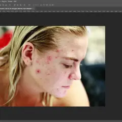 Młoda kobieta z trądzikiem na twarzy, edytowana w Photoshopie. Widoczny panel warstw i narzędzie pędzel photoshop.