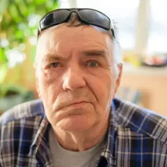 Mężczyzna z widocznym porażeniem nerwu twarzowego, opuszczony kącik ust po prawej stronie.