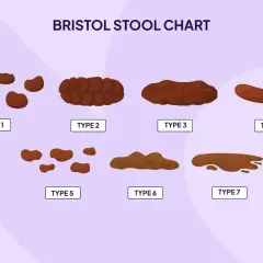 Wykres Bristolskiej Skali Stolca pokazuje 7 typów, od twardych grudek (typ 1) po płynne (typ 7). Typ 6 i 7 mogą wskazywać, ile trwa biegunka.
