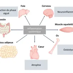 Schéma montrant l'inflammation systémique affectant le muscle squelettique, entraînant une fonte musculaire. D'autres effets incluent le cerveau, le foie, le cœur, les os, l'intestin, le tissu adipeux et la réaction de phase aiguë.