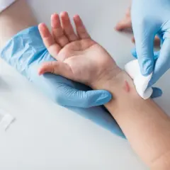 Lekarz w niebieskich rękawiczkach opatruje ranę na nadgarstku dziecka, która może być objawem ziarniny zapalnej.